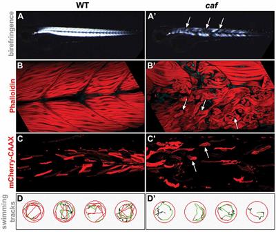 Zebrafish Models of LAMA2-Related Congenital Muscular Dystrophy (MDC1A)